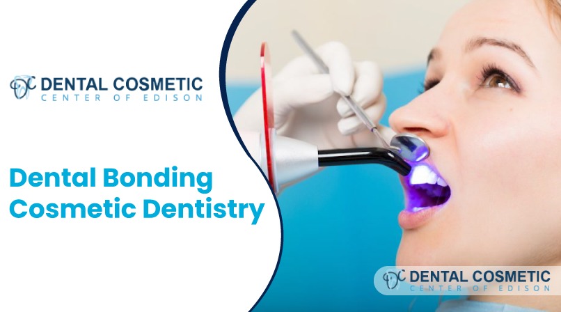 A simple guide for dental cosmetic bonding.