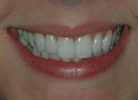 Success Stories of Dental Cosmetic