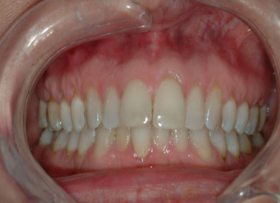 Success Stories of Dental Cosmetic