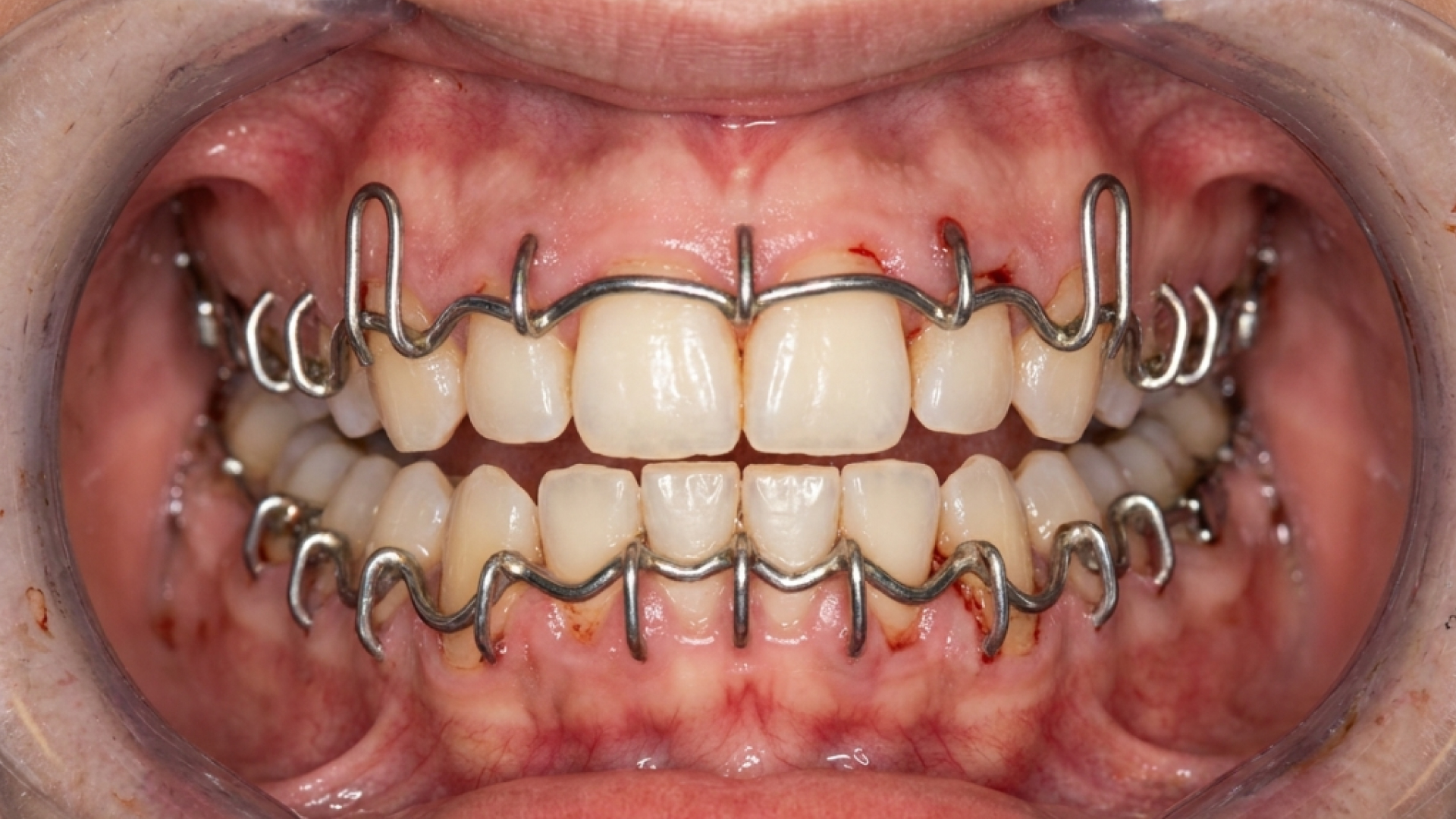 Dental Cosmetic Center Edison