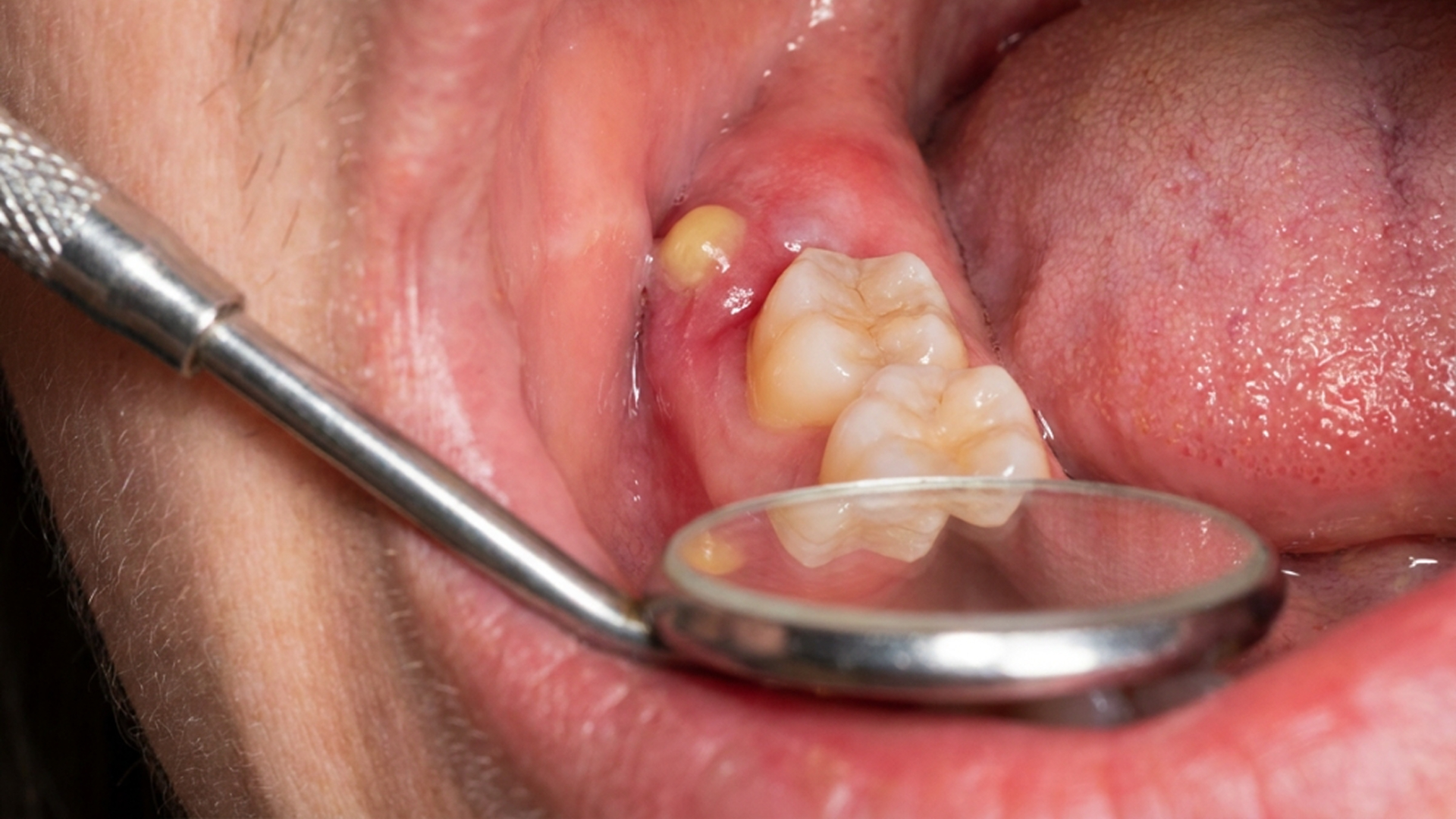 Dental Cosmetic Center Edison