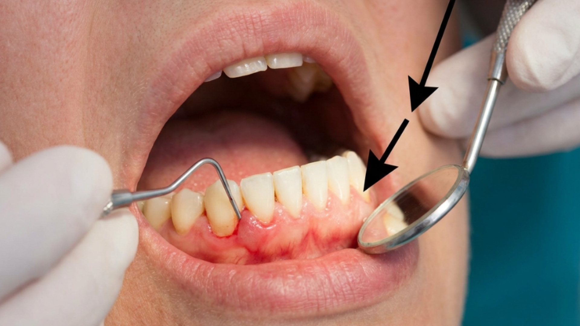 Dental Cosmetic Center Edison
