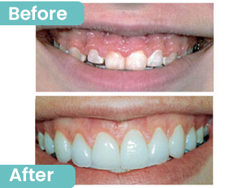 Cosmetic Dentistry Clinic