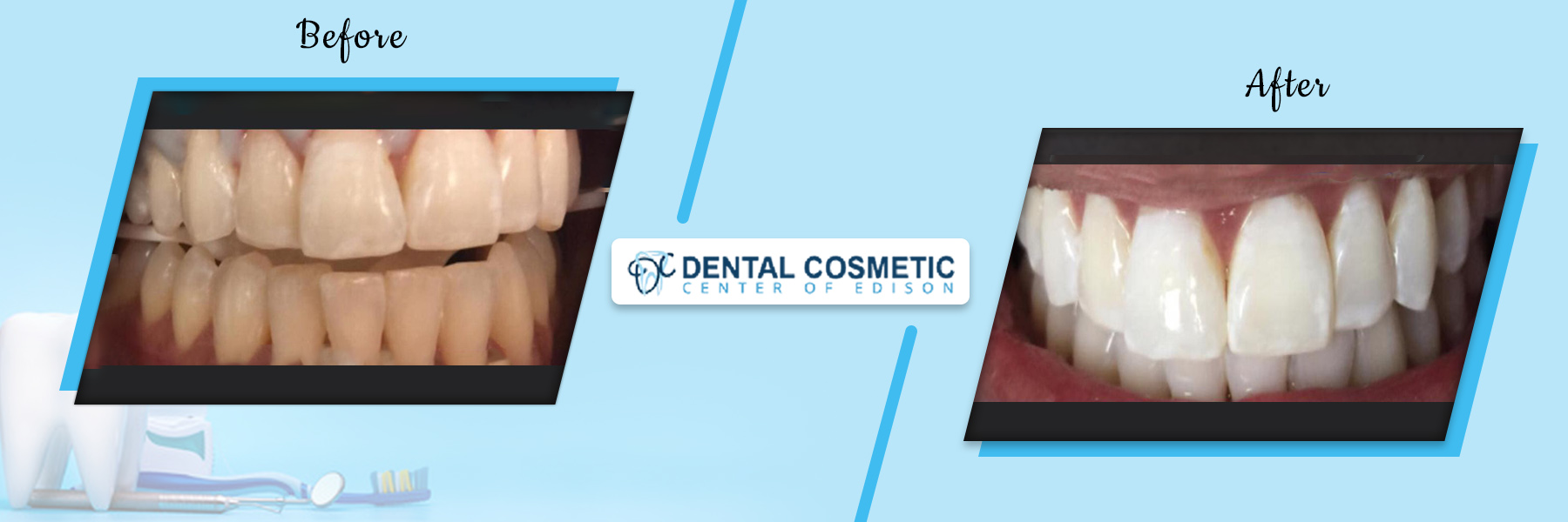 Dental Cosmetic Center Edison, Dental Clinic in Edison Dental Cosmetic